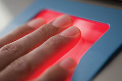 Biometric fingerprint technology